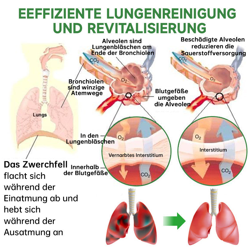 Furzero™ Atementgiftendes-Kräuterlungenreinigungsspray