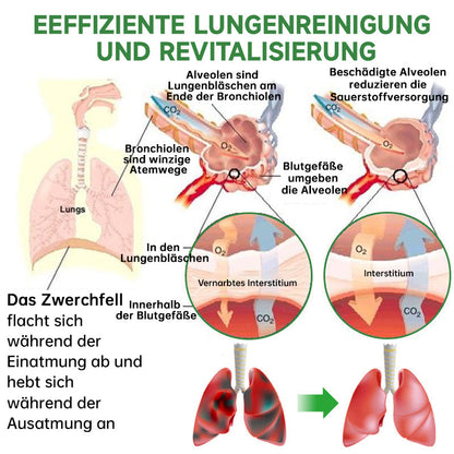 Furzero™ Atementgiftendes-Kräuterlungenreinigungsspray