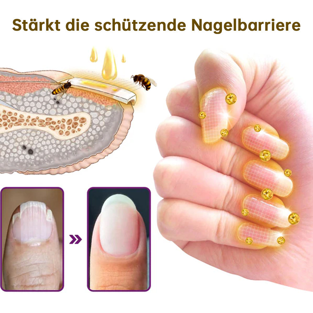 🐝🐝flysmus™ FungiFree Bienengift Nagelbehandlungsserum