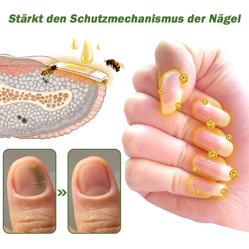 👍Furzero™ Nagelverteidigung Bienengift-Behandlungsserum pro