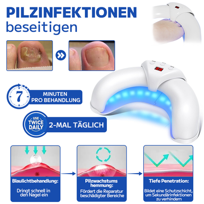 Furzero™ Pilzbehandlungs-Lasergerät für Nägel