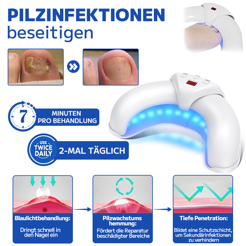 Furzero™ Effektive Pilz-Nagel-Behandlungs-Lasergerät-