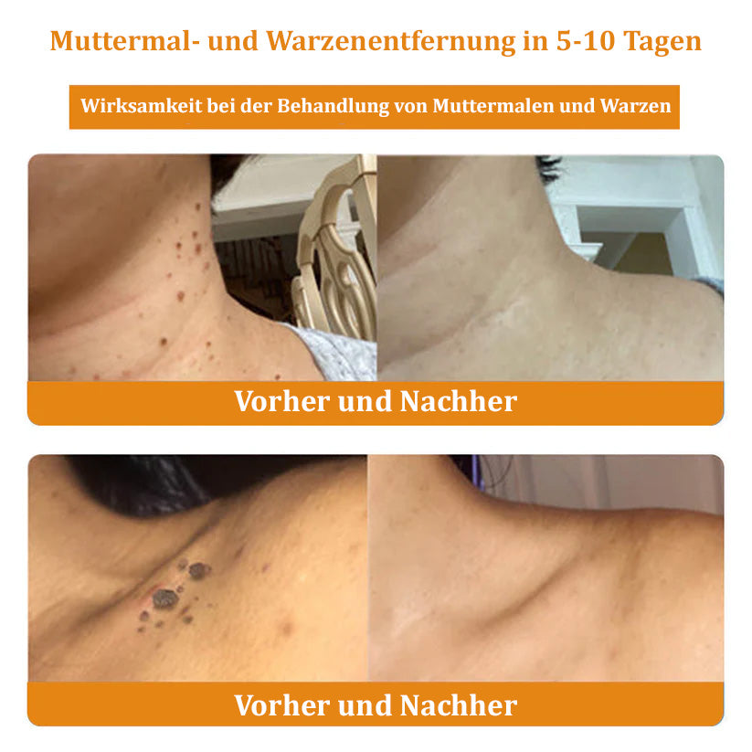 Furzero™ Bienengift-Hautpflegeserum (👩‍⚕️✅ Dermatologisch getestet)