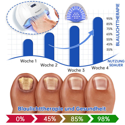 🌈Furzero™ PureNail Pilz-Lasertherapiegerät