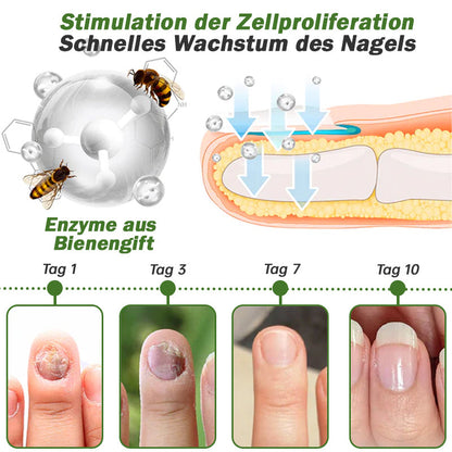 👍Furzero™ Nagelverteidigung Bienengift-Behandlungsserum pro