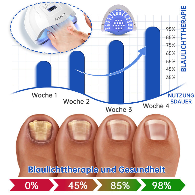 🔥🔥Furzero™ PureNail Pilz-Lasertherapiegerät