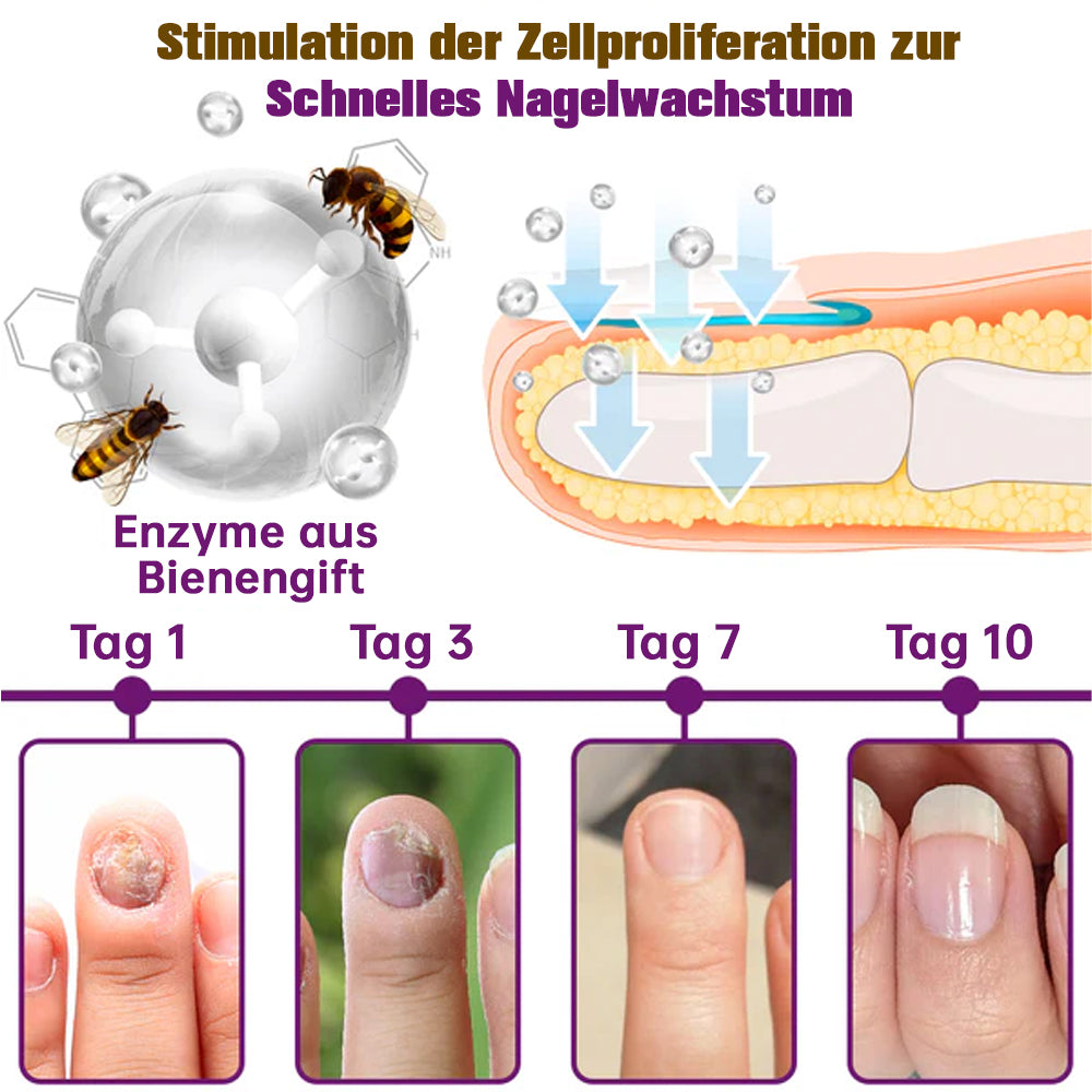 🐝🐝flysmus™ FungiFree Bienengift Nagelbehandlungsserum