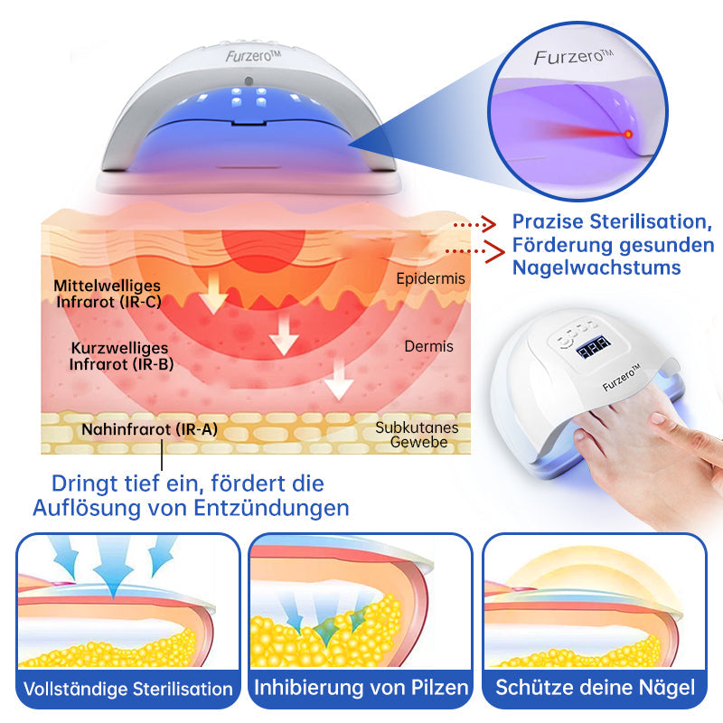 🌈Furzero™ PureNail Pilz-Lasertherapiegerät