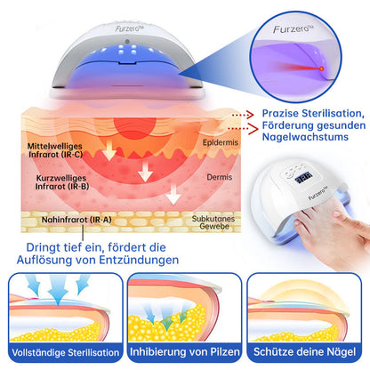 🌈Furzero™ PureNail Pilz-Lasertherapiegerät