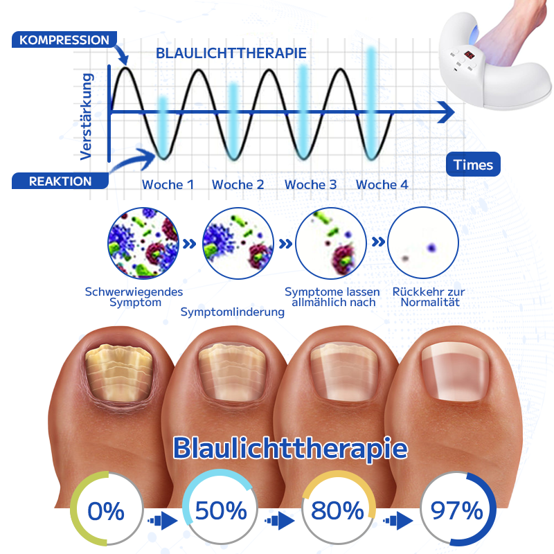 Furzero™ Effektive Pilz-Nagel-Behandlungs-Lasergerät-