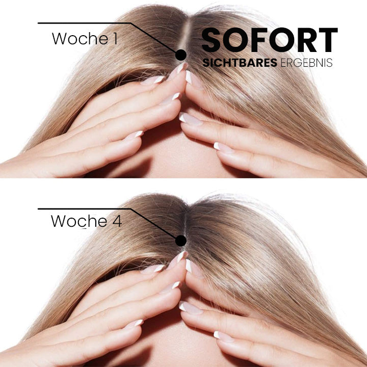 🔥Furzero™ ShougaGRO Japanisches Haarwachstumsspray (🔥Zeitlich begrenzter Rabatt, letzte 30 Minuten)