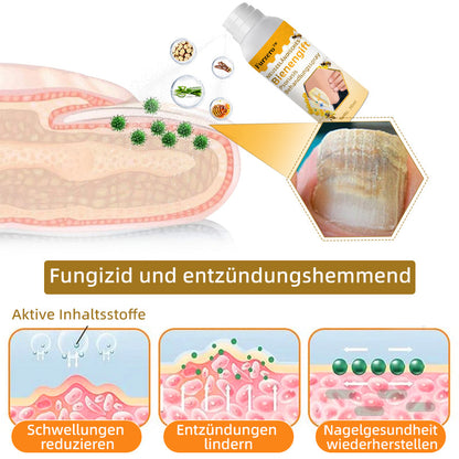 🧑‍⚕️Furzero™ Neuseeländisches Bienengift Psoriasis Behandlungsspray (Geeignet für alle Hauttypen)