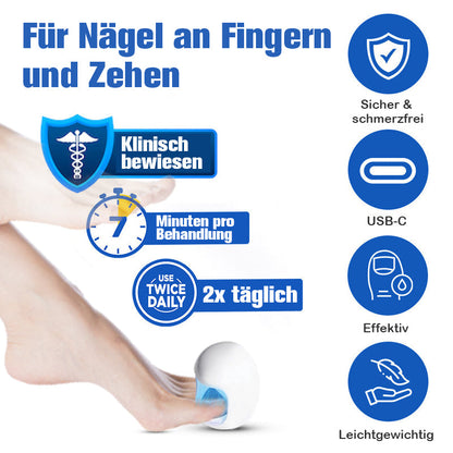 Furzero™ Nagelpilzreinigung Laser Linderungsgerät