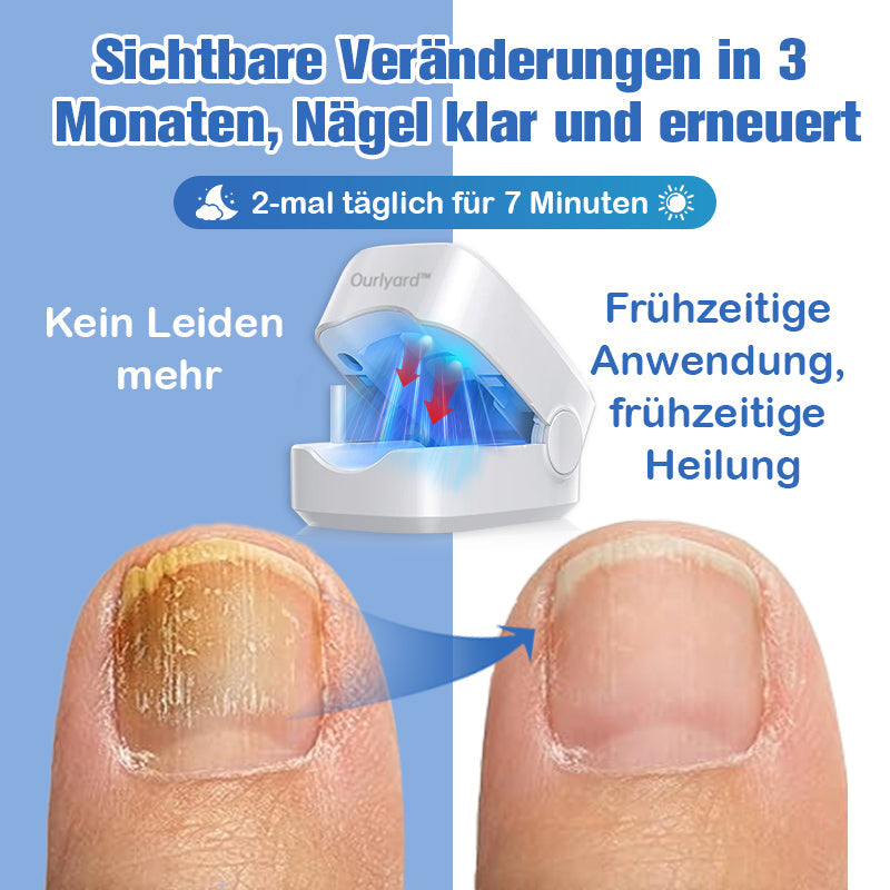 Furzero™ Nagelpilz-Laserbehandlungsgerät