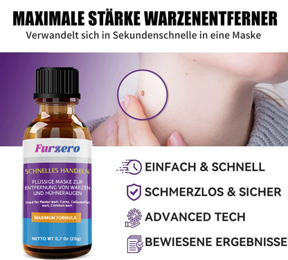 Furzero™ Leistungsstarke Flüssigmaske zur Entfernung von Warzen und Hühneraugen