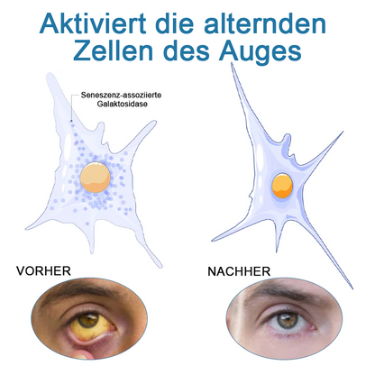 Ourlyard™ Behandlung Augenprobleme Lösung Tropfen