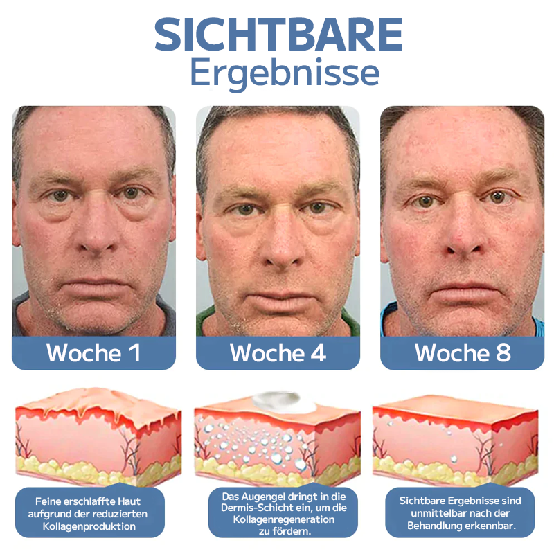 OPENEYES Erwachen Peptid-Straffendes Augengel