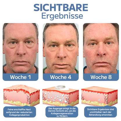 OPENEYES Erwachen Peptid-Straffendes Augengel