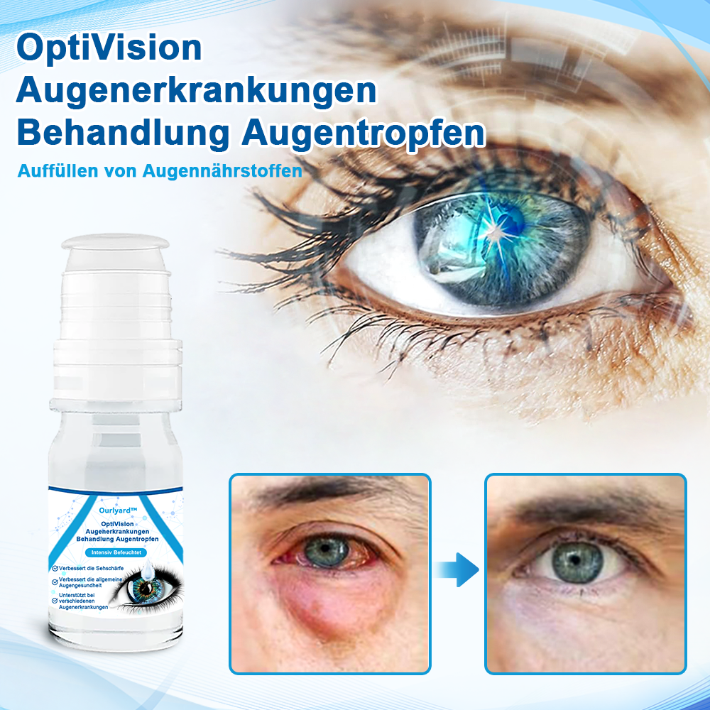 Ourlyard™ OptiVision  Augenerkrankungen  Behandlung Augentropfen