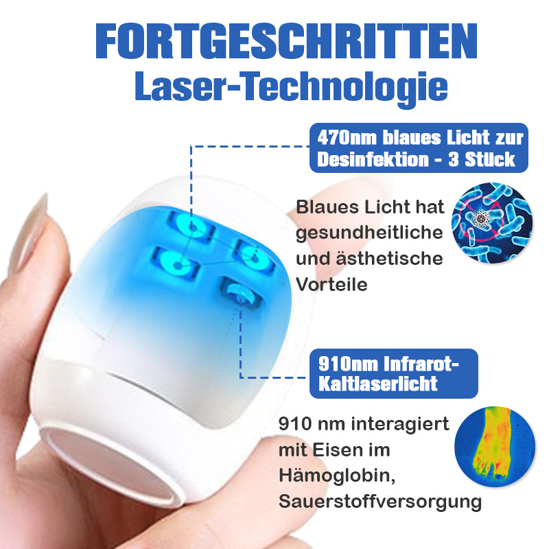 Furzero™ Nagelpilzreinigung Laser Linderungsgerät