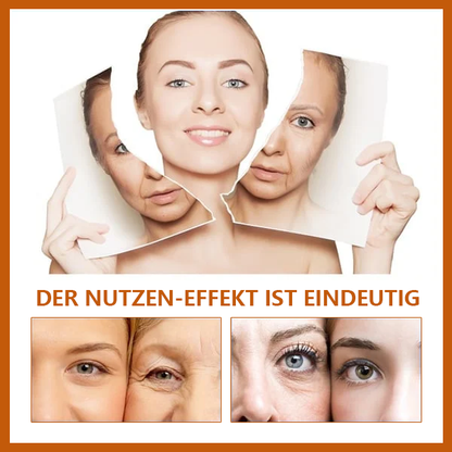 🔥Ungültige volle Rückerstattung🔥Last Day Promotion 49% OFF - 🔥Furzero™ Retinol Botox Gesicht Serum