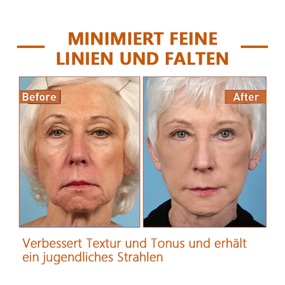 🔥Ungültige volle Rückerstattung🔥Last Day Promotion 49% OFF - 🔥Furzero™ Retinol Botox Gesicht Serum