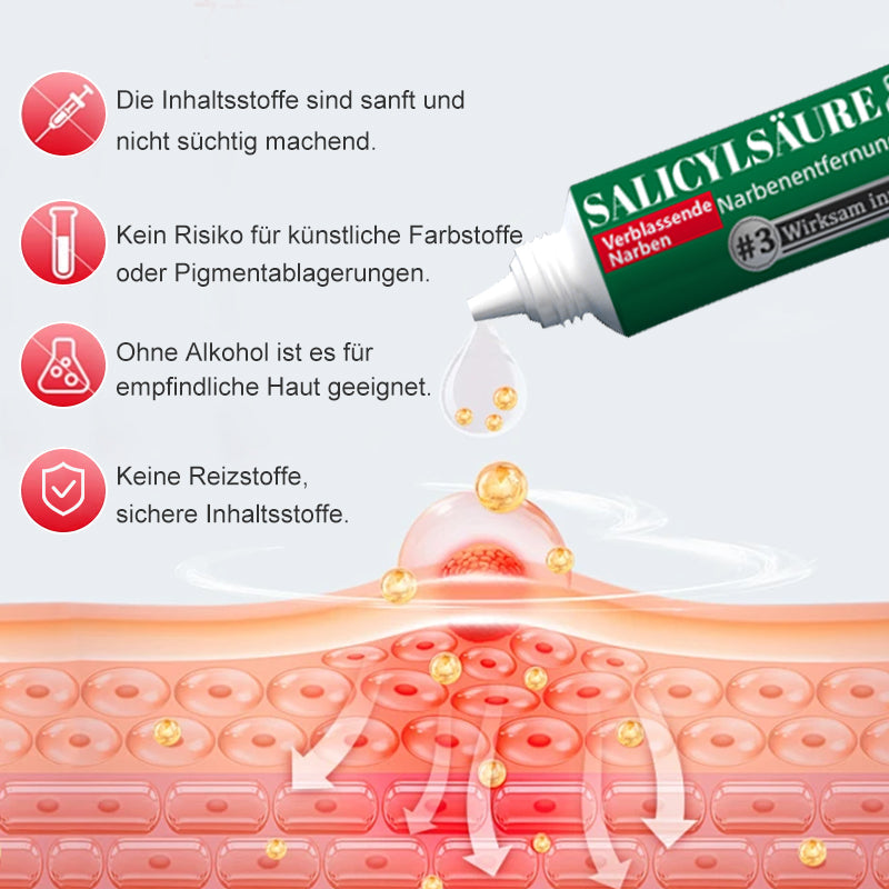 Ourlyard™ Salicylsäure-Narbenentfernungs-Gel