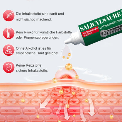 Ourlyard™ Salicylsäure-Narbenentfernungs-Gel