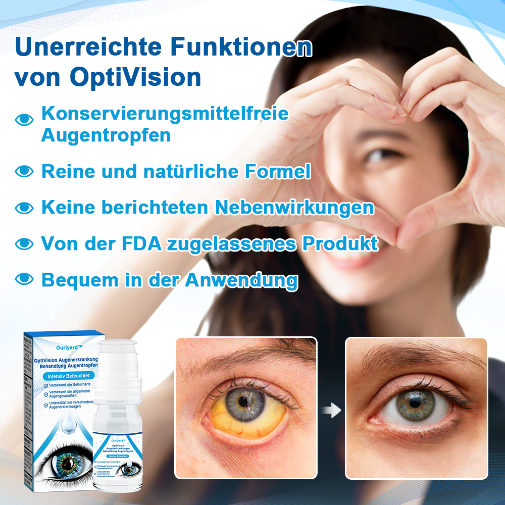 Ourlyard™ OptiVision  Augenerkrankungen  Behandlung Augentropfen