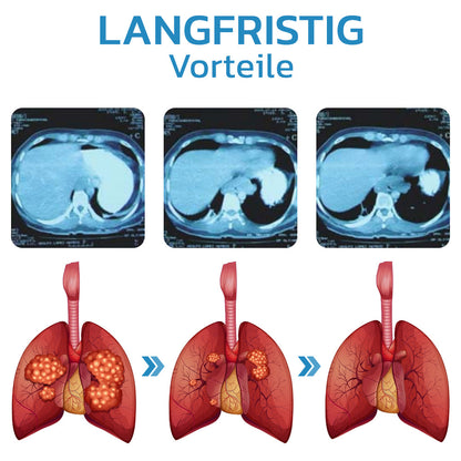 GFOUK™ EasyBreath Lungenreinigungsgerät